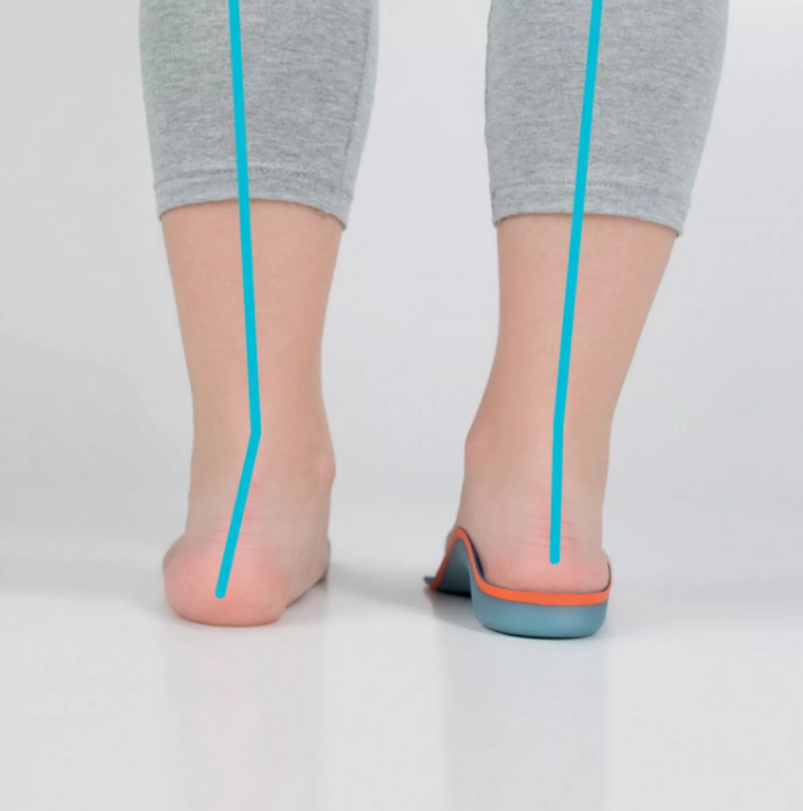 Детские ортопедические Полустельки 3151 Bauerfeind, купить в OrtoMir24